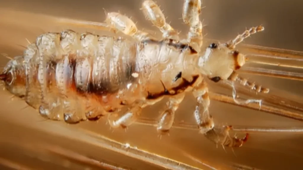 Does Washing Your Hair Every Day Kill Lice